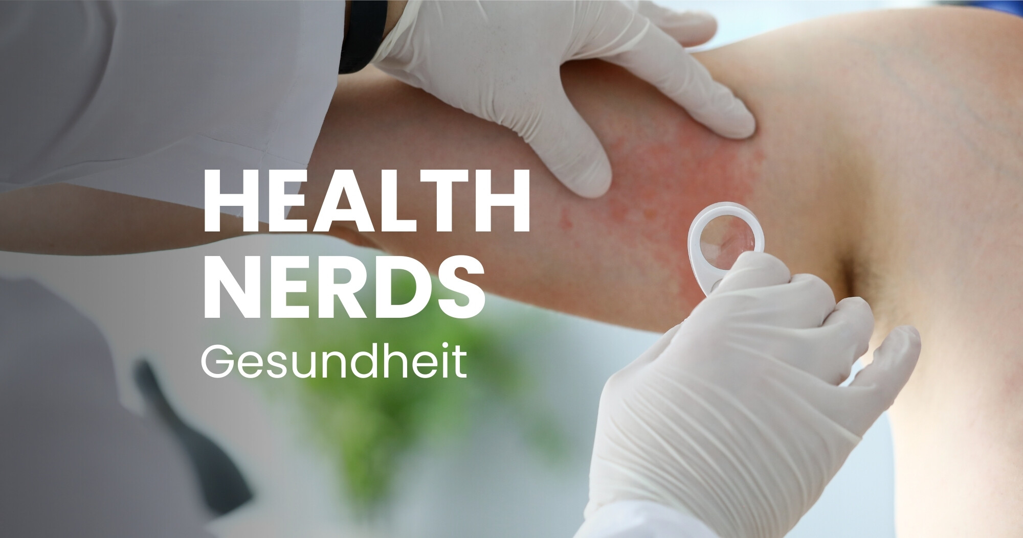 Histaminintoleranz entschlüsselt: Wenn Lebensmittel plötzlich krank machen
