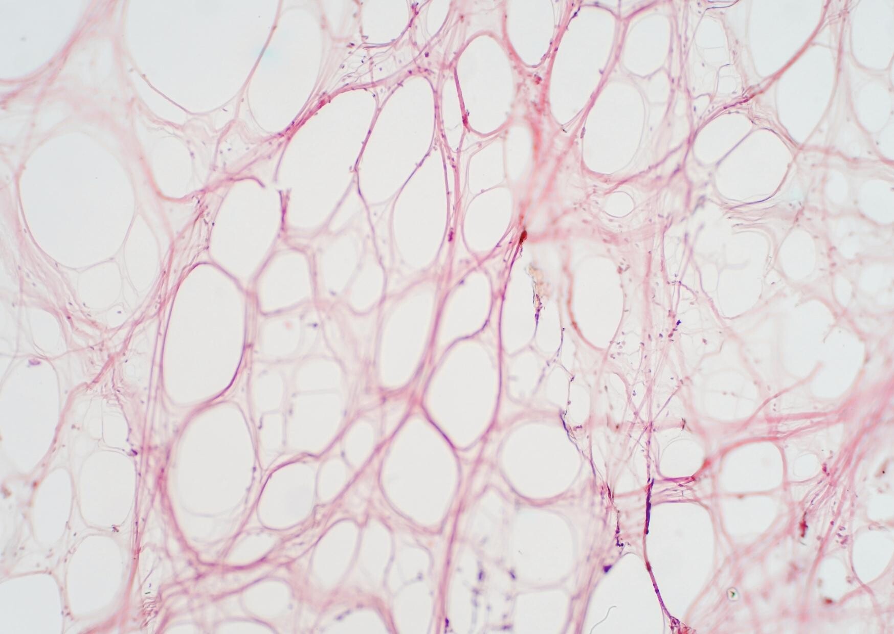 Cholesterin senken: So unterstützt Du Herz & Gefäße natürlich 