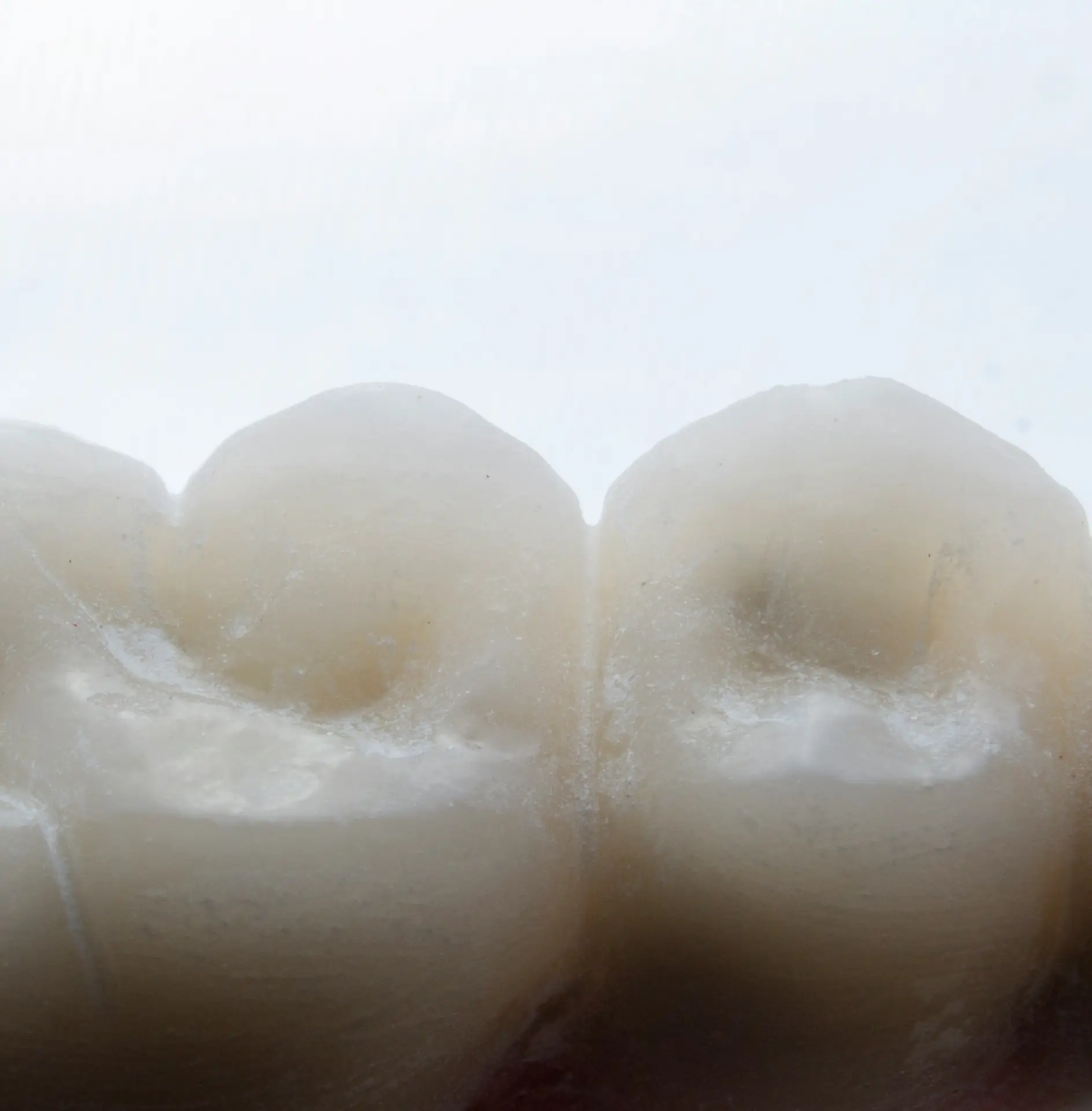 Floral | Probiotische Zahnprophylaxe Bild zu Reduktion von Zahnbelag